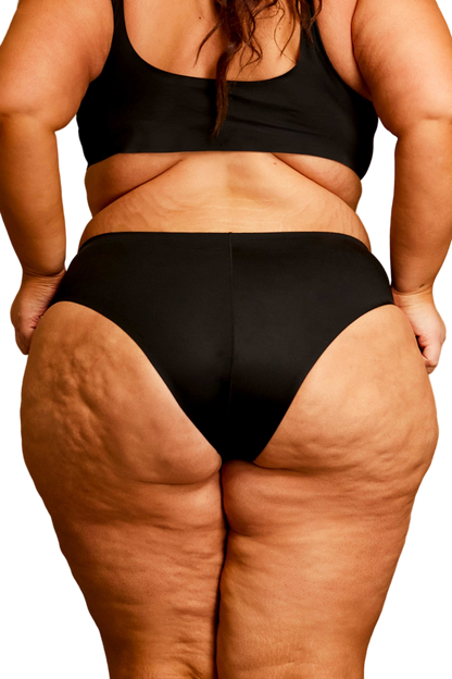 Woodmont Cheeky Bikini Bottom | FINAL SALE